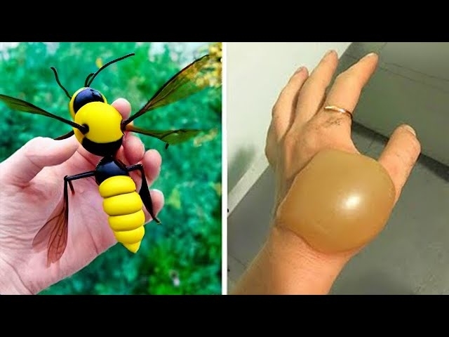 20 Most Painful Insect Bites In The World