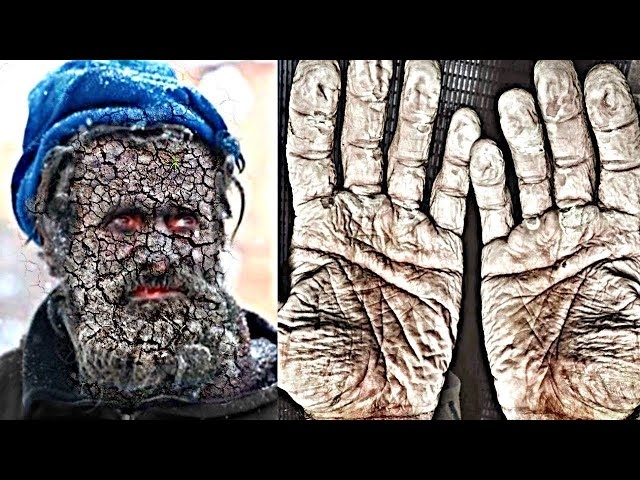The Man Who Hasn't Bathed In 65 Years