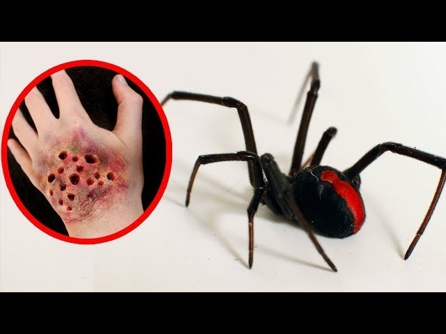 THE MOST POISONOUS SPIDERS In The World